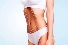 Liposuction in Turkey: Excellence in Cosmetic Surgery at Celyxmed